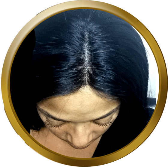 Image of Lace Closure