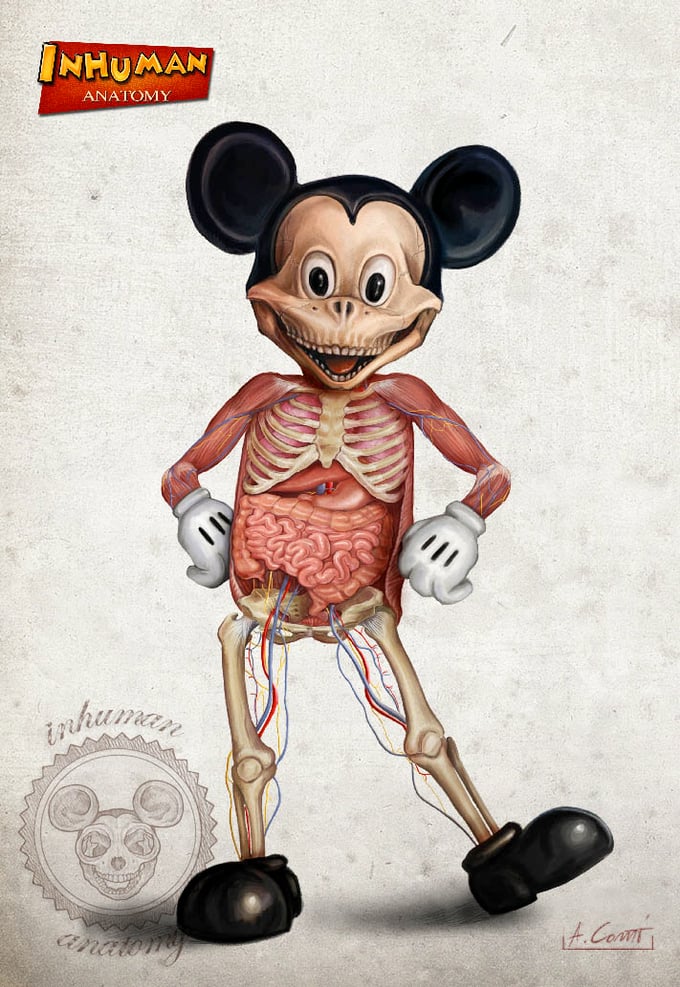 Image of INHUMAN ANATOMY "Mickey's anatomy" limited edition of 100 Giclèe print on fine art canvas