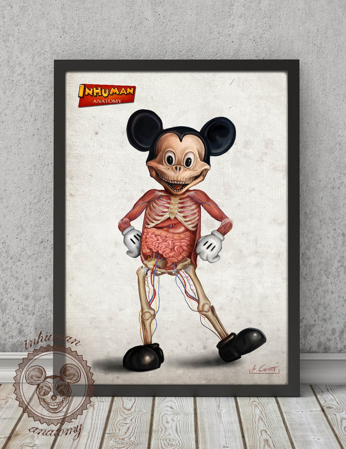 Image of INHUMAN ANATOMY "Mickey's anatomy" limited edition of 100 Giclèe print on fine art canvas