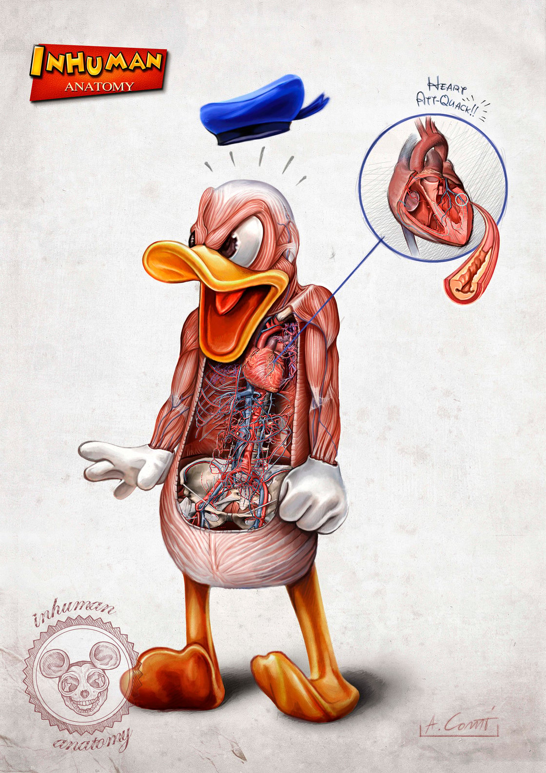 Image of INHUMAN ANATOMY - Donald's anatomy - limited edition of 100 - Giclèe print on fine art canvas