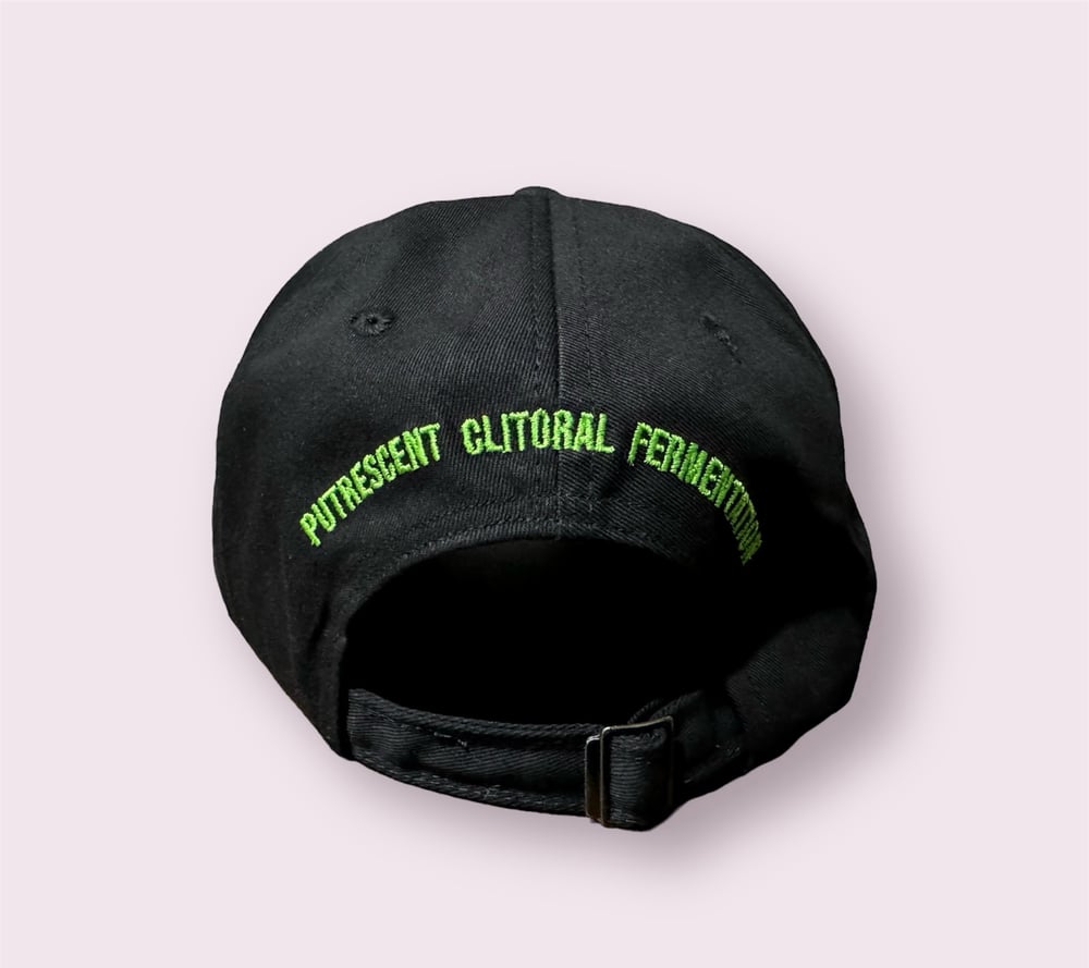 Vulvectomy - Dat Hat