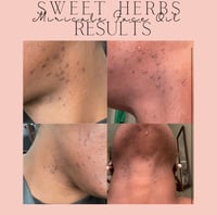 Image 2 of Potent Sweet Herbs Miracle Face Oil