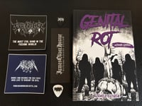 Genital Rot - Ultimate Edition Signed Hardcover 