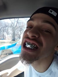 Image 2 of Silver per tooth 