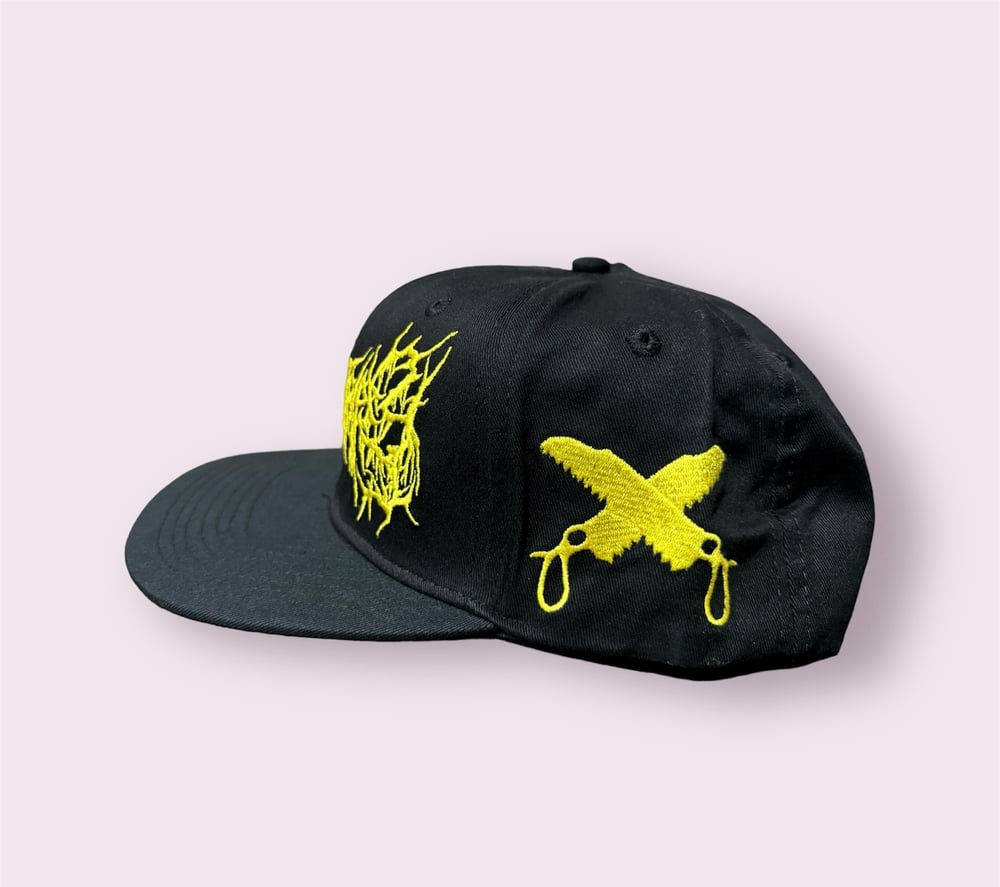 Cephalotripsy - Snapback