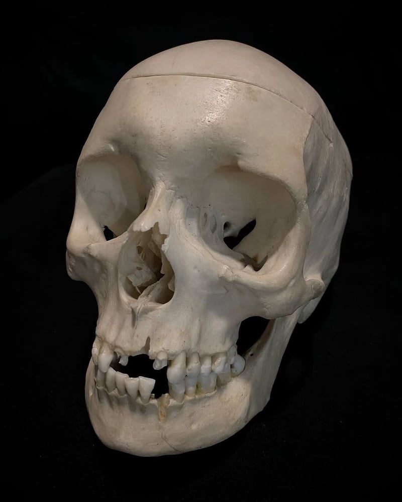Image of Real Human Skull