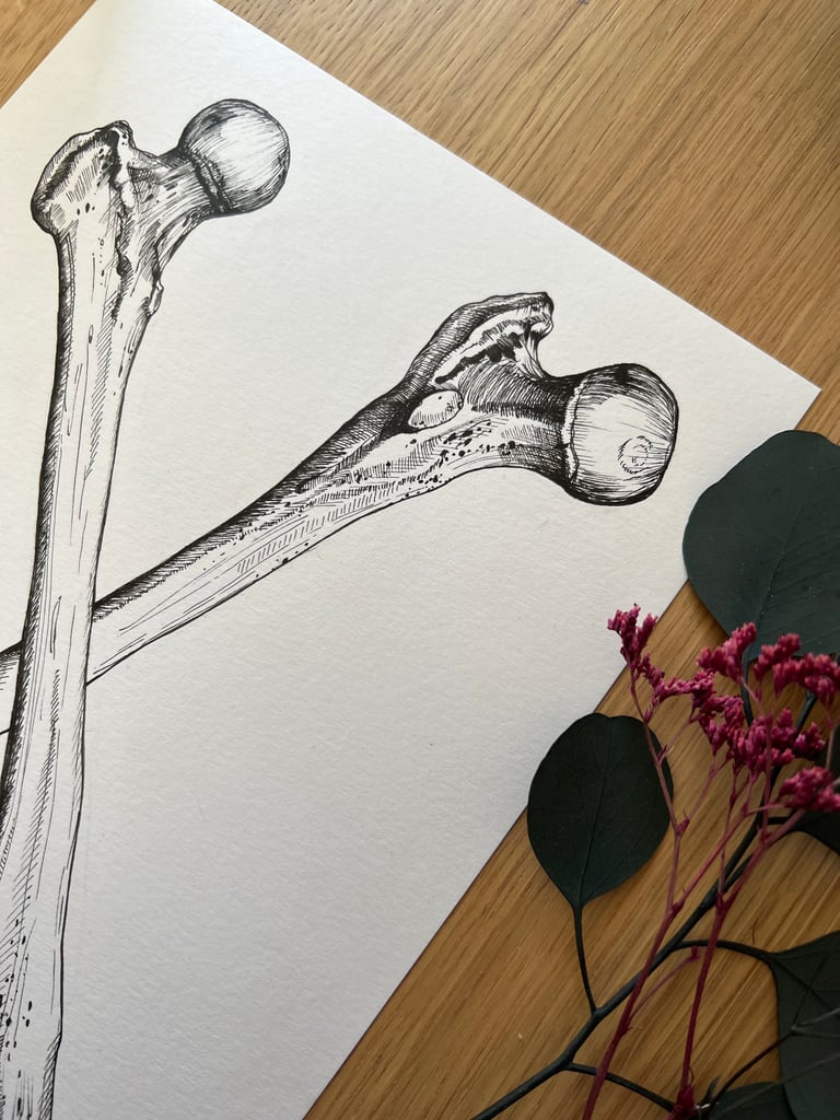 Illustration PRINT « Fémurs » Format A4 Image 5
