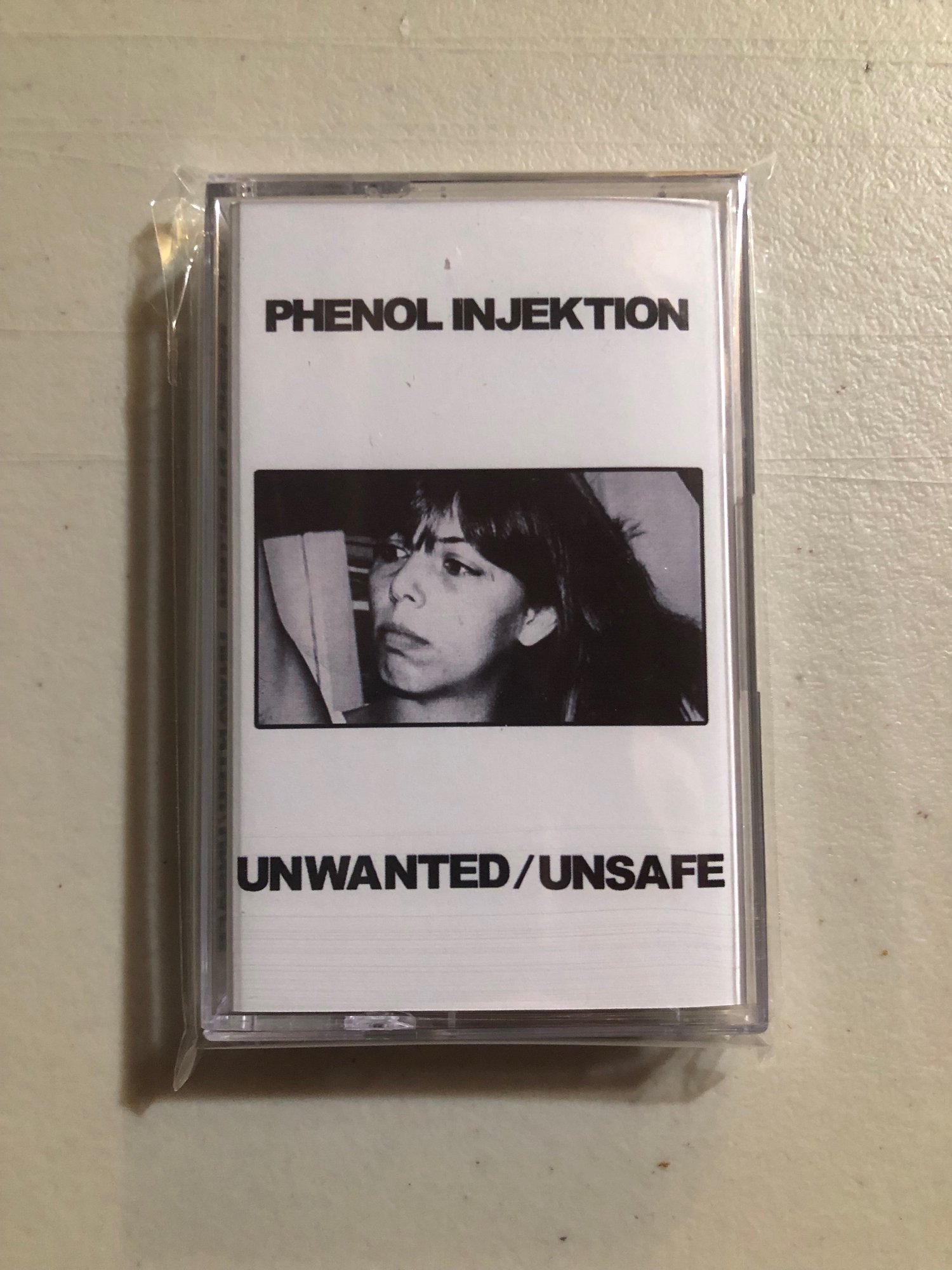 Phenol Injektion - Unwanted/Unsafe CS (Death In Venice)