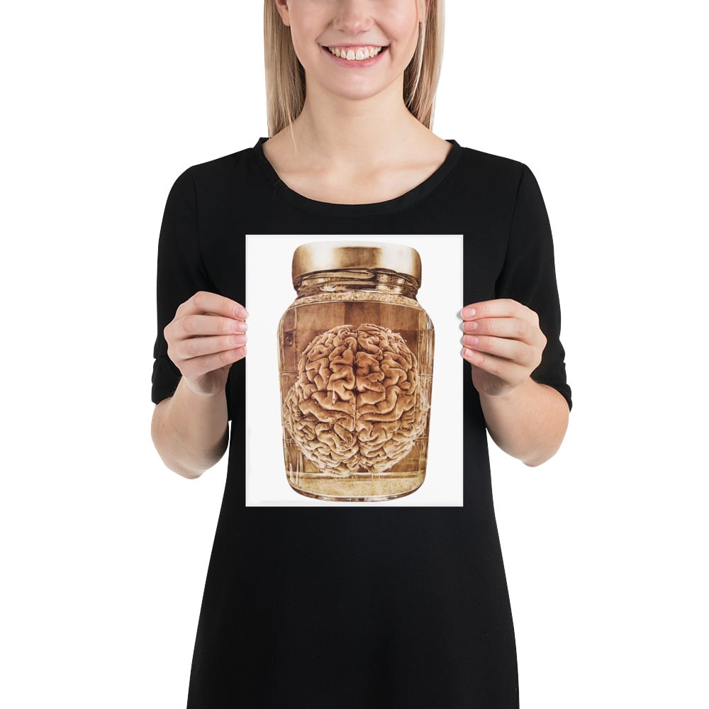 Photo Print: Brain Wet Specimen (white)