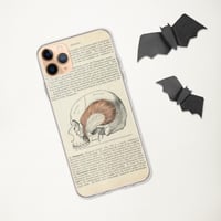 Image 3 of Antique Bookpage Detailed Anatomical Illustration Human Skull Clear Case for iPhone®