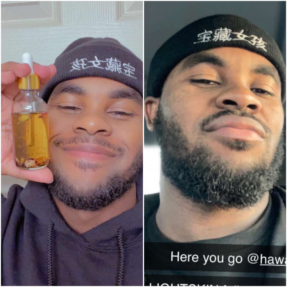 Image of Beard Growth 