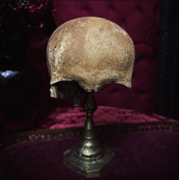 Image of Male Human Skull 