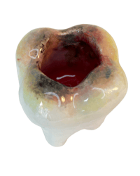 Image 5 of Decaying Tooth holder