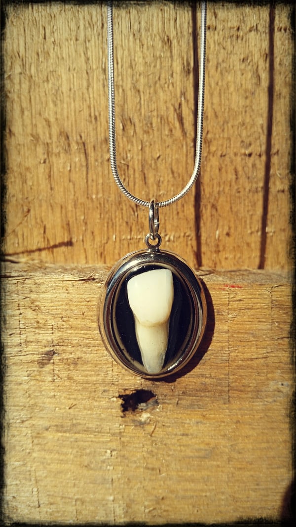 Image of Human Incisor Necklace