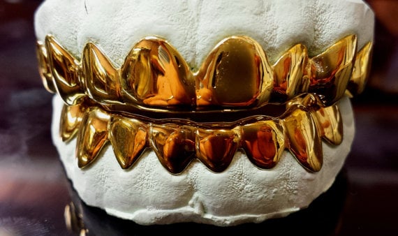 Image of 18K Gold Grillz