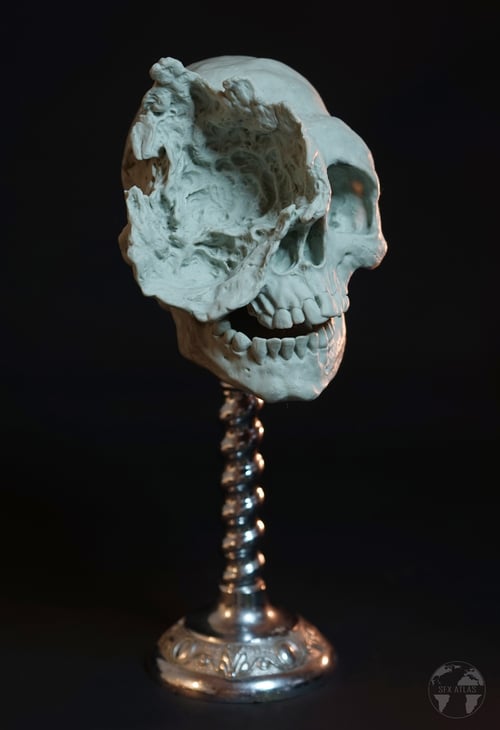 Image of Deformed Human Skull