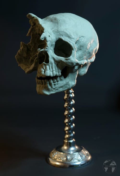 Image of Deformed Human Skull