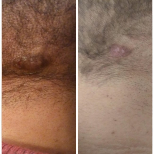 Image of Pat's Healing Hands Skin Healing Sap