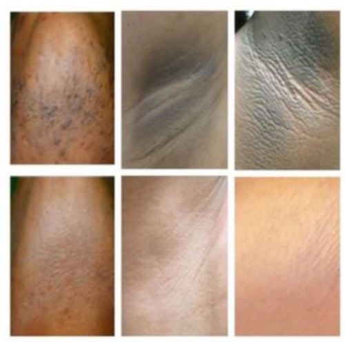 Image of Skin Lightening Cream/Crema Para Aclarar La Piel