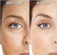 Image of Under Eye Wrinkle Cream/Crema antiarrugas para ojos