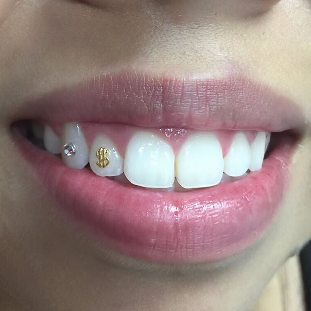 tooth gems