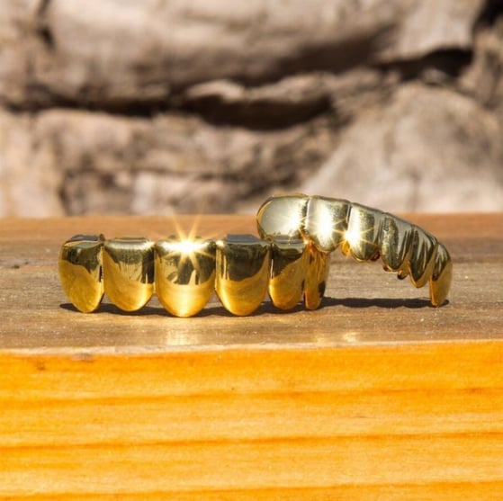 Image of 18k Gold Teeth Full Set