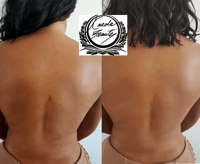 LIPO SCAR FADE CREAM