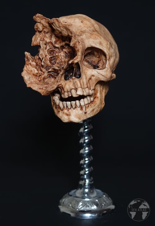 Image of Exploded Skull