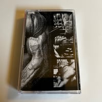 Hypertrophy - Sarcoplasmic/Myofibrillar