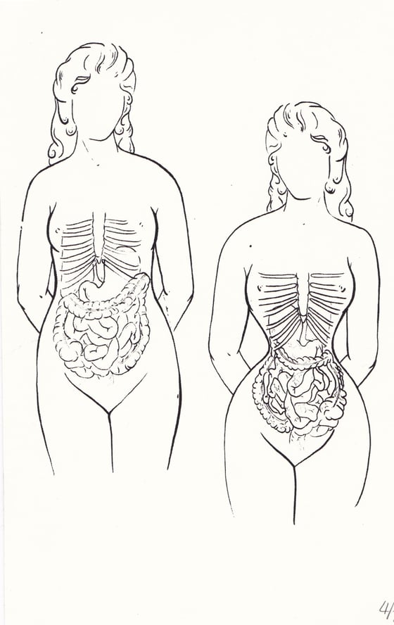 Image of Effects of Victorian Corsetry