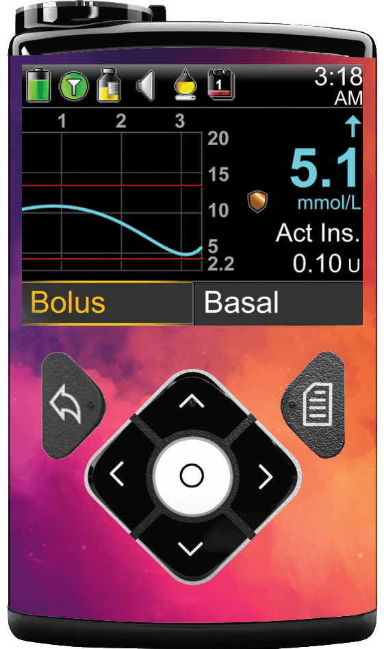 Image of Stardust Medtronic Minimed 600/700 series