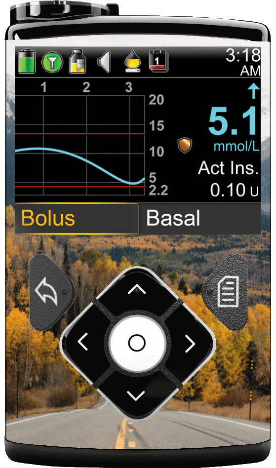 Image of Road Trip Medtronic Minimed 600/700 series