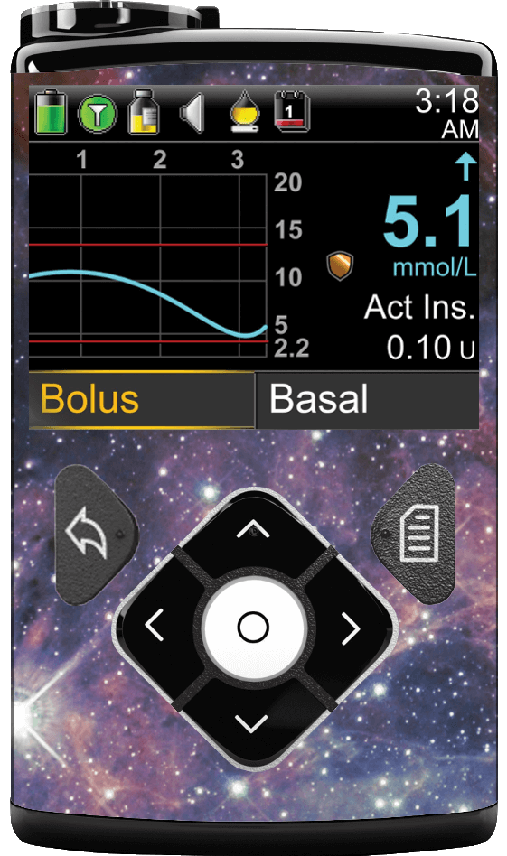 Image of Stargaze Medtronic Minimed 600/700 series