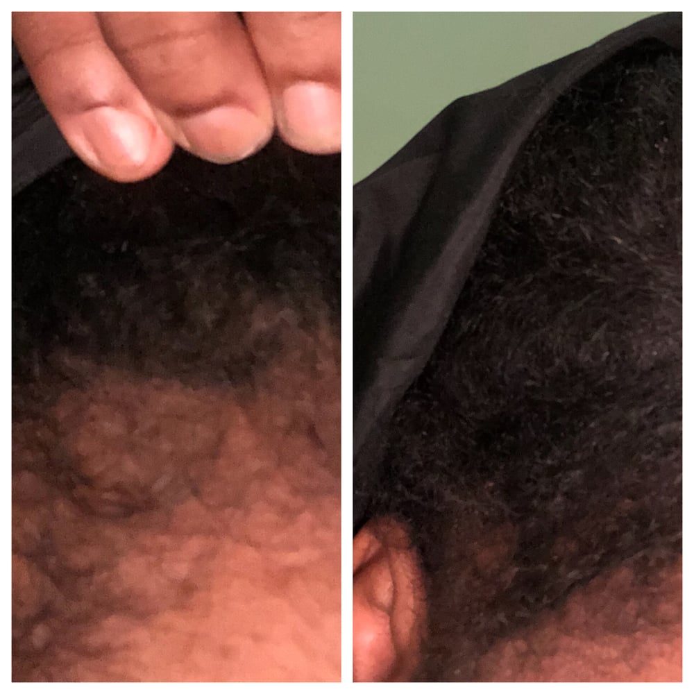 Image of Hair growth oil