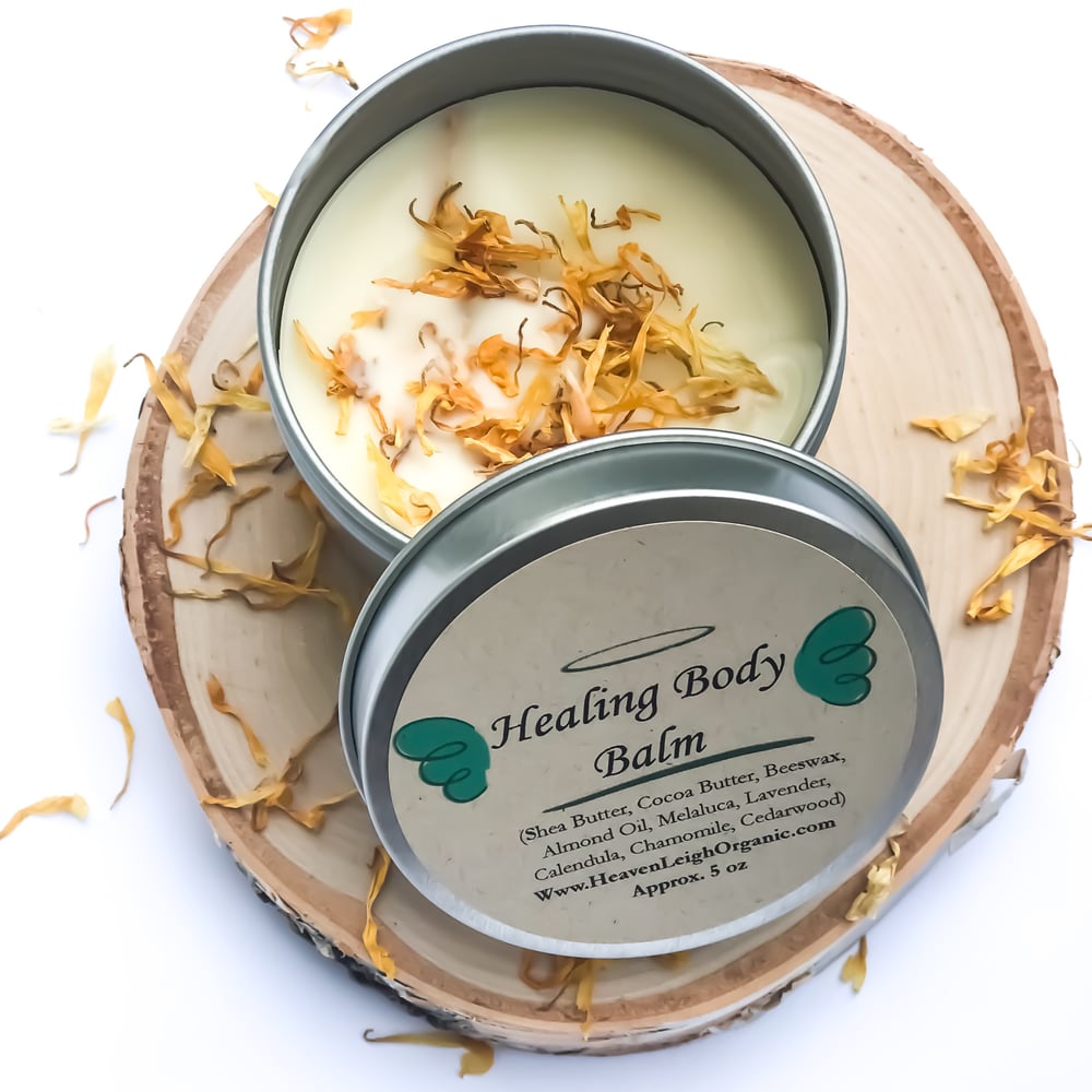 Image of “Healing Body Balm” - Dry Skin, Eczema Cream