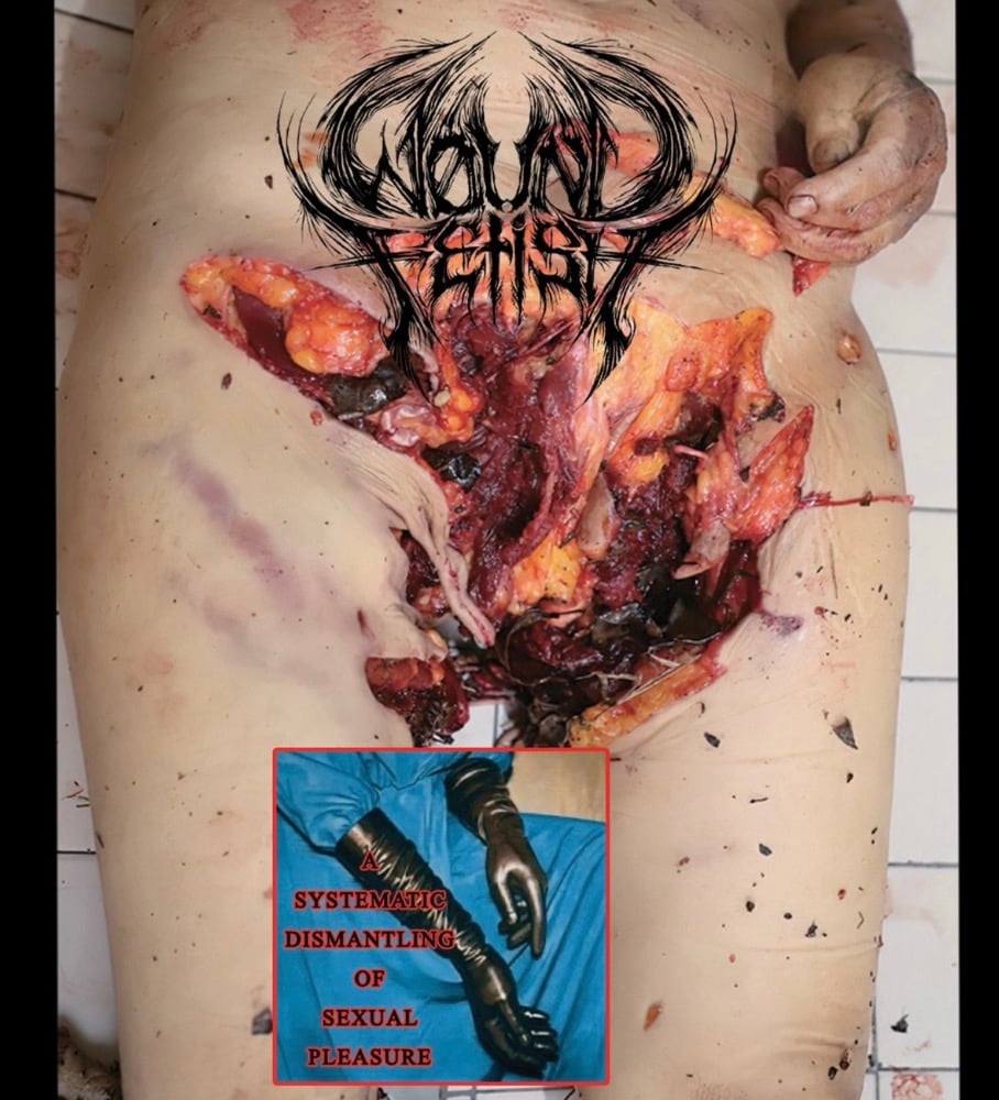 Wound Fetish - A Systematic Dismantling of Sexual Pleasure Cassette