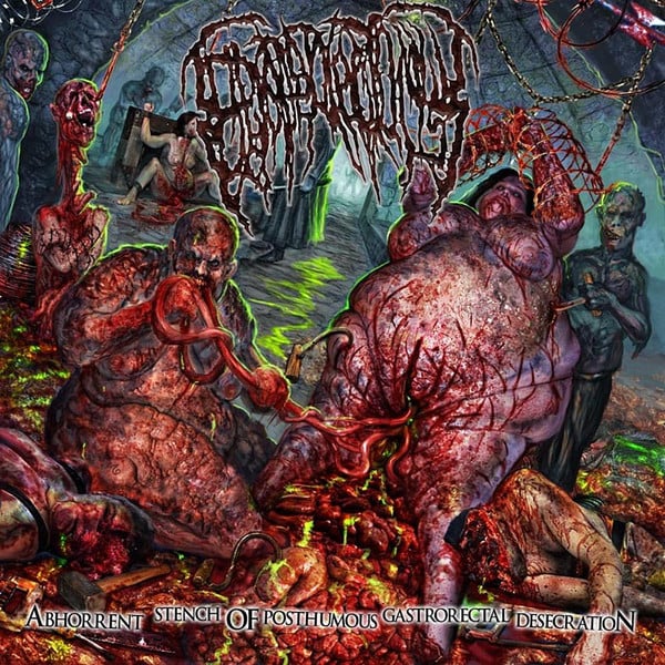 EPICARDIECTOMY CDs / Tape