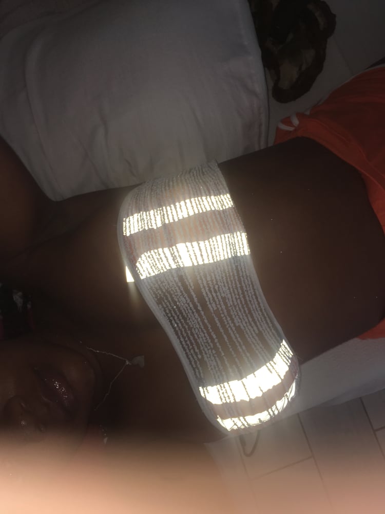 Image of REFLECTIVE | STRIPE BIKINI ✴️