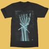 Tendinitis T-Shirt