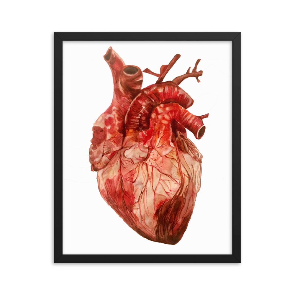Image of Anatomical Heart Study