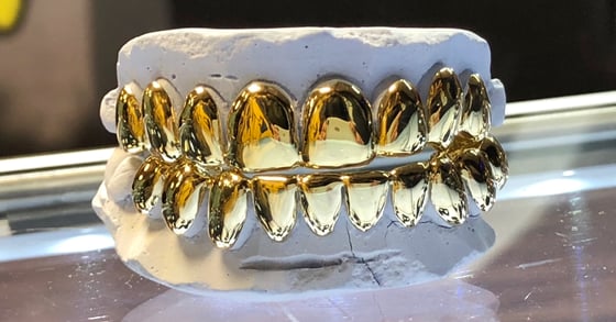 Image of PERMANENT STYLE GOLD GRILLZ - SOLD PER TOOTH