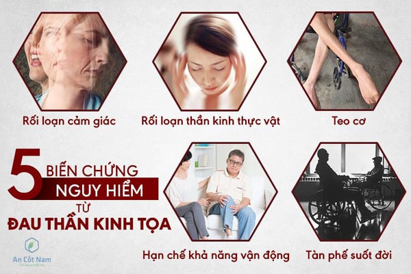 Image of Chữa đau thần kinh tọa ở đâu tốt nhất tại Hà Nội 2019