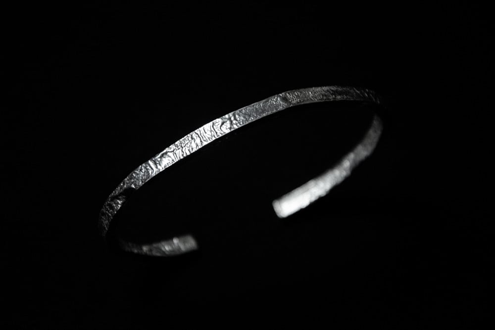 Image of Fracture Line