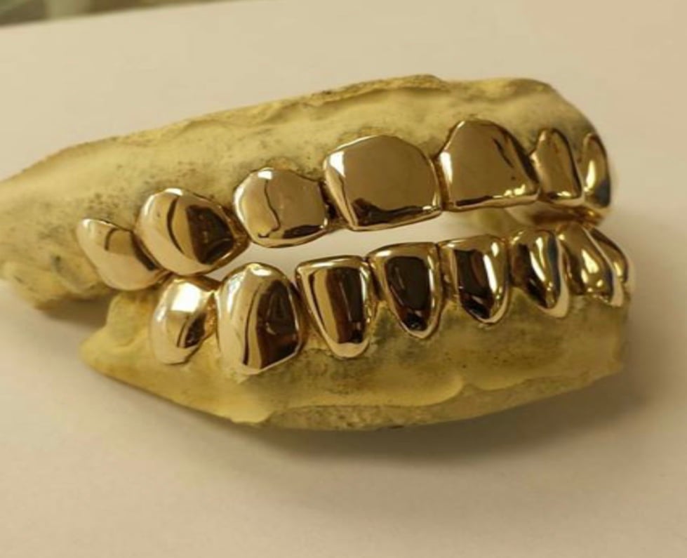 Image of 10k Yellow Gold Permanent Grillz