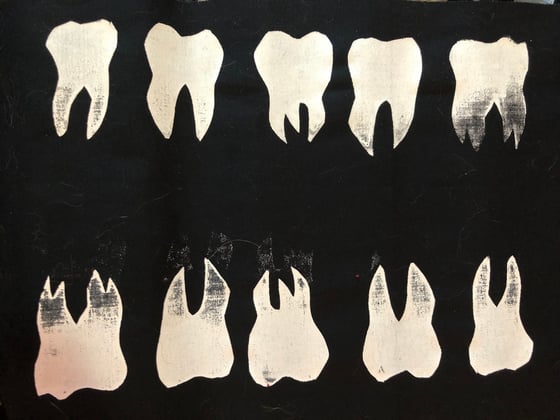 Image of MOLAR MOON PHASES 5 teeth patches - BLACK COTTON OR RED VELVET