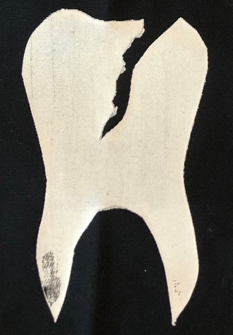 Image of CRACKED TOOTH patch