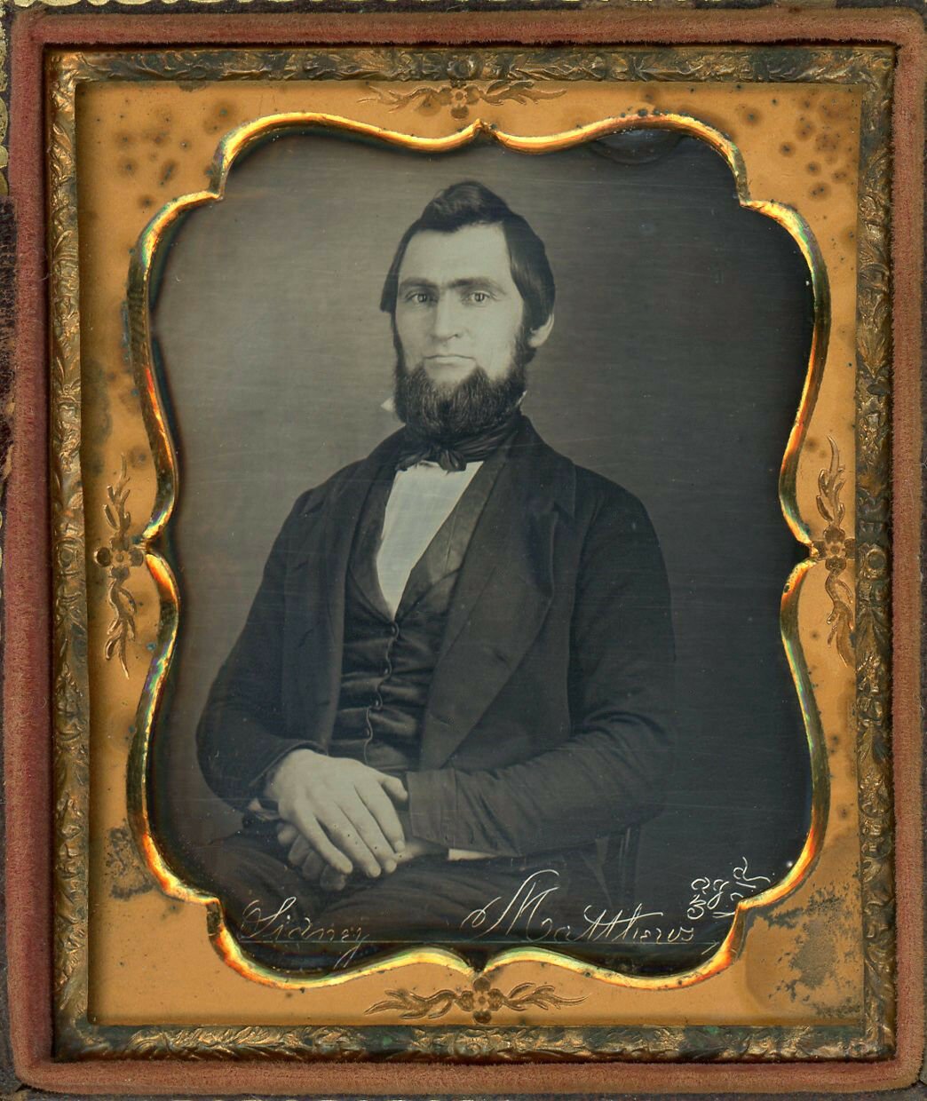 Image of rare Etched daguerreotype: 'Sidney Matthews Age 32, ca. 1855