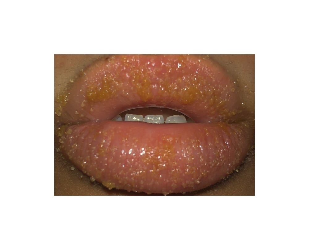 Image of SUGAR LIPS