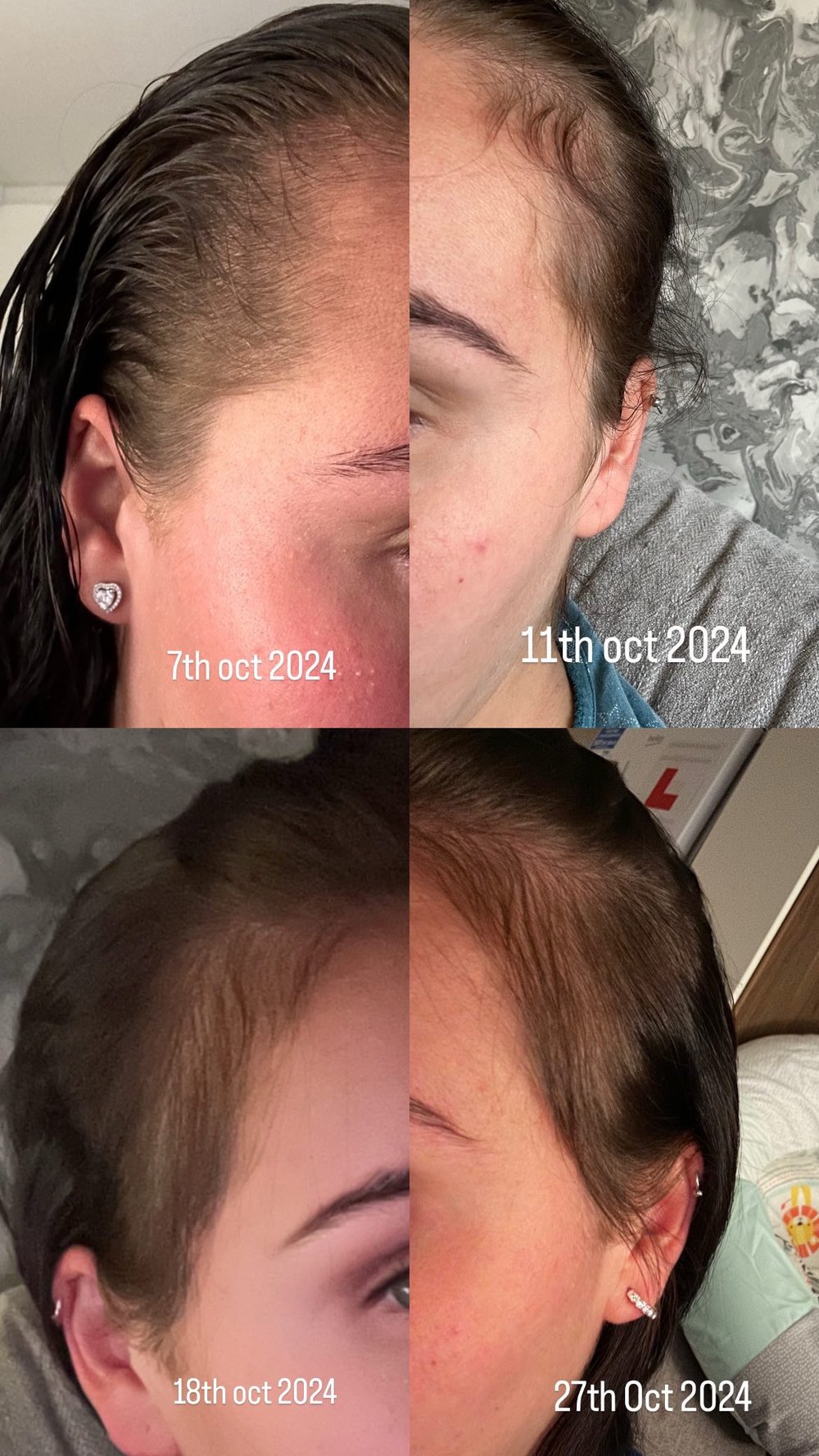 Image of Hair Growth Oil