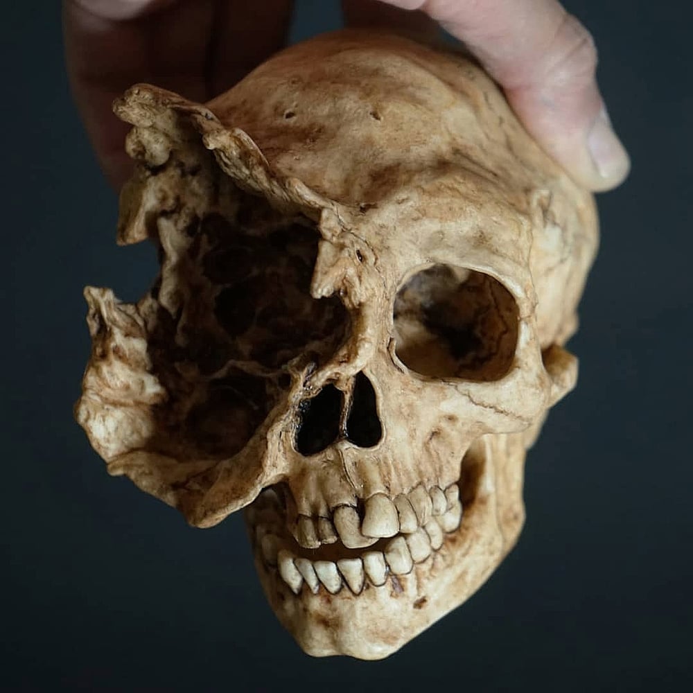 Image of Exploded Skull